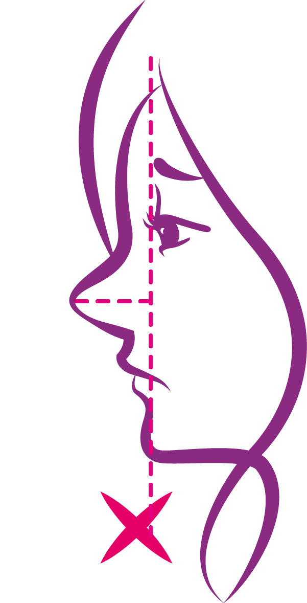 刻意模仿名人鼻型
